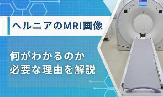 ヘルニア mri