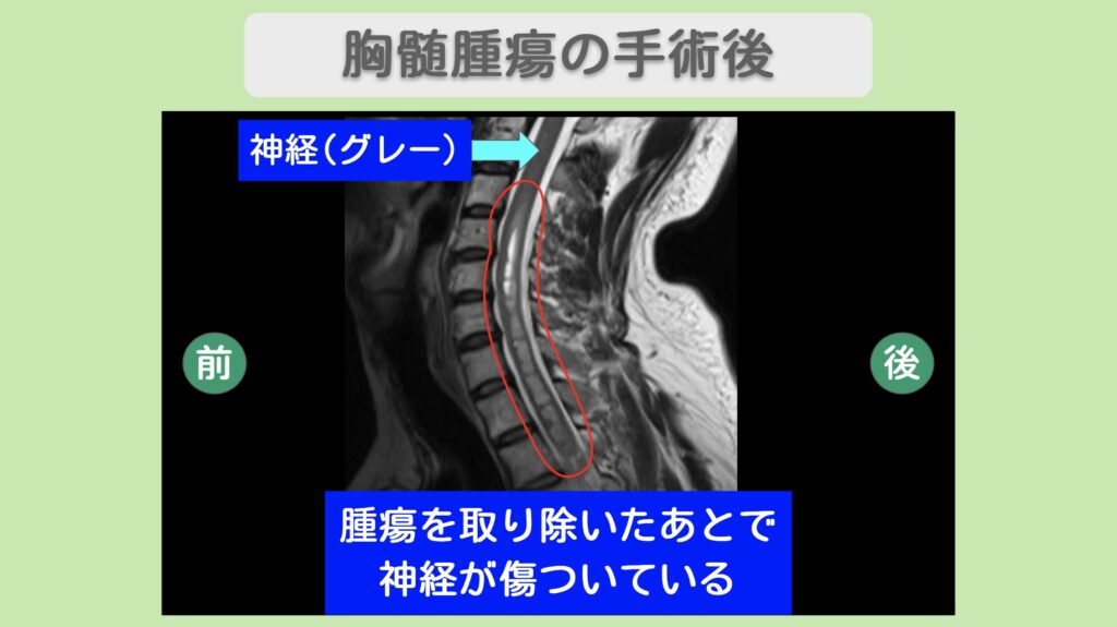 リペア幹細胞