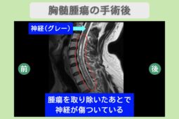 case 909 mri 1