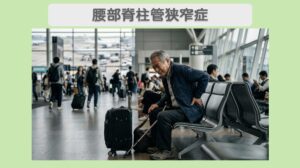 腰部脊柱管狭窄症のイメージ画像