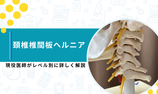 頚椎ヘルニア 症状 レベル