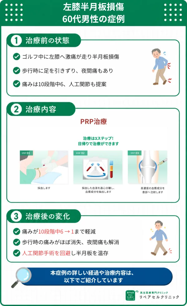 人工関節を回避し痛みが10段階中6から1まで軽減した60代男性の症例