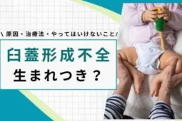 臼蓋形成不全 生まれつき