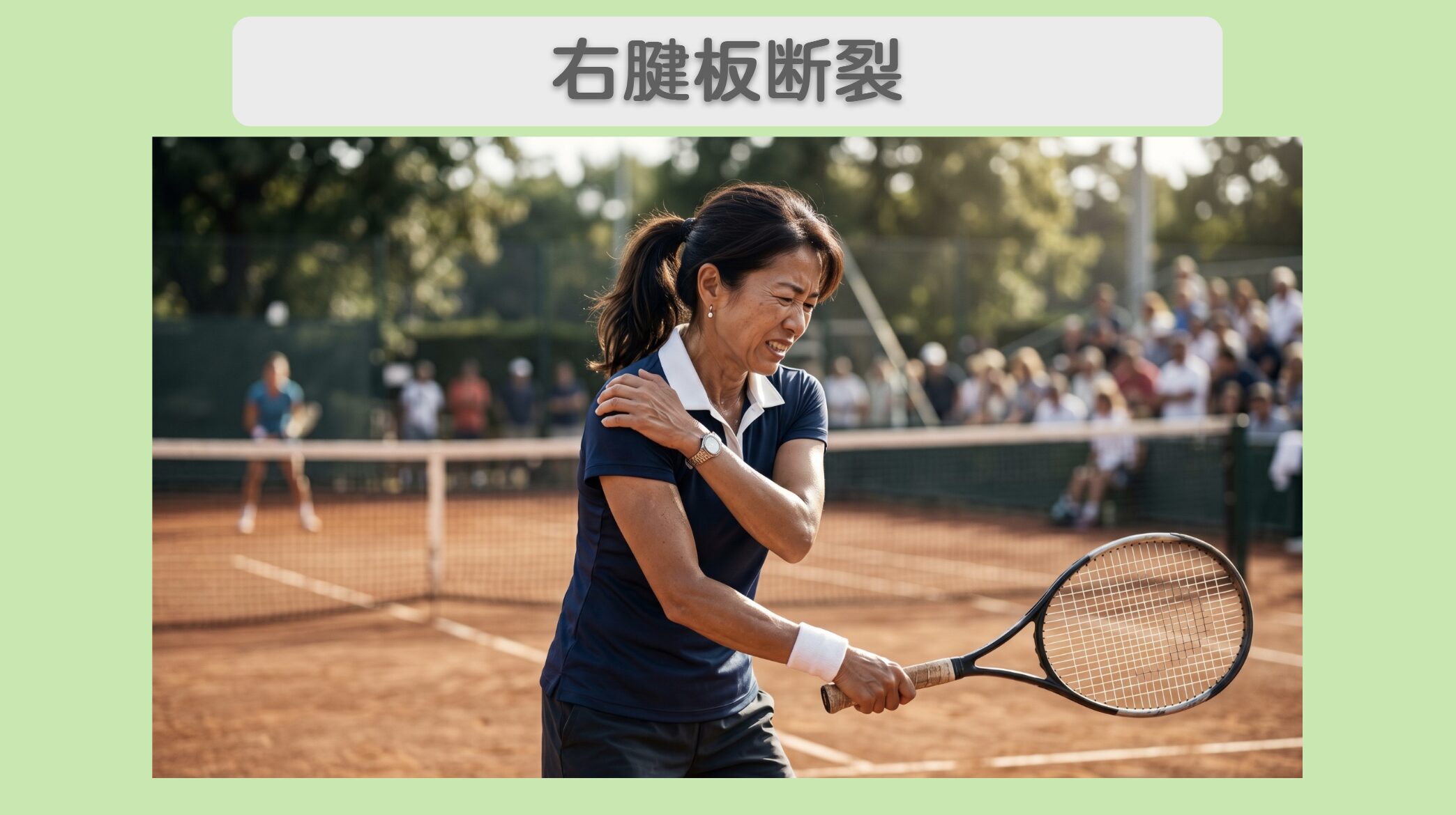 右腱板断裂