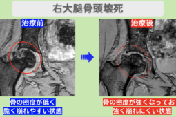 990 hip mri 2026