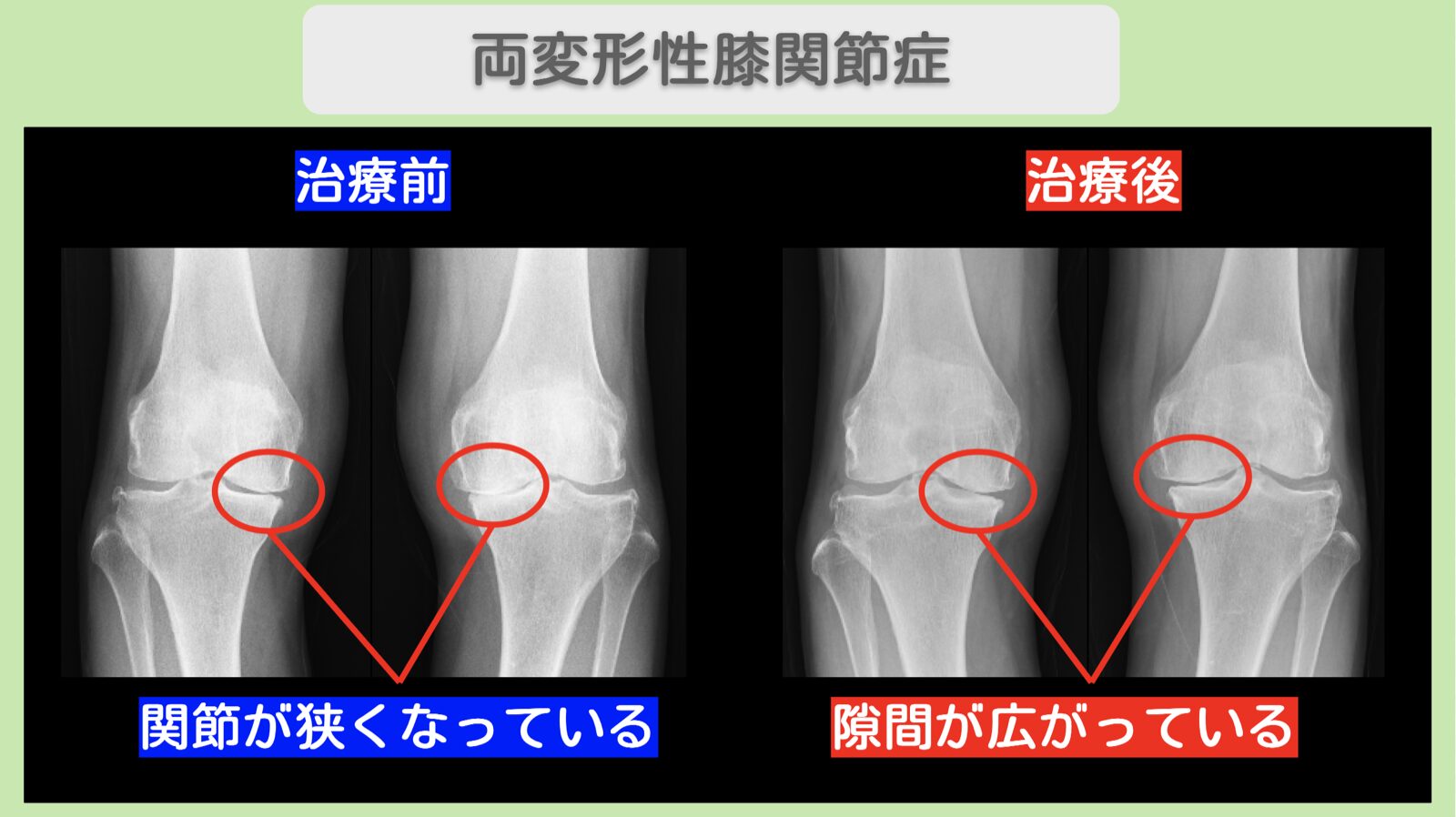 O1154 knee 2026