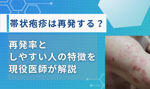 帯状疱疹 再発