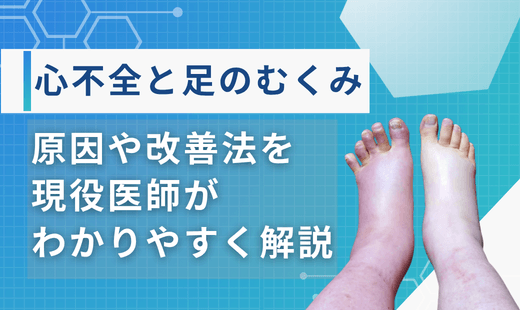 心不全とむくみ