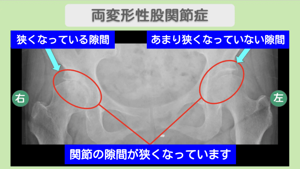 62c37771092463a9cb74cd946125eacb