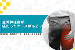坐骨神経痛 癌だった