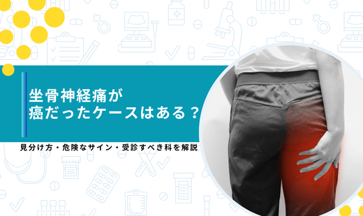 坐骨神経痛 癌だった