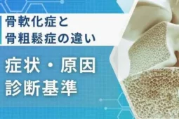骨軟化症 骨粗鬆症 違い