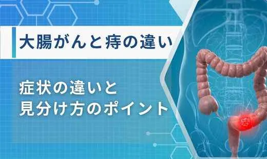 大腸がんと痔の違い