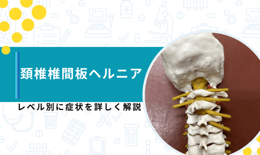 頚椎ヘルニア 症状 レベル