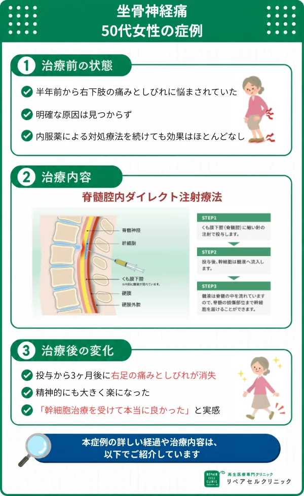 坐骨神経痛の症例画像
