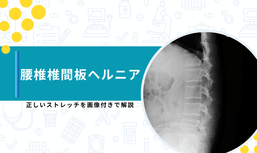腰椎椎間板ヘルニア