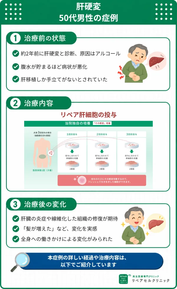 肝硬変の症例画像