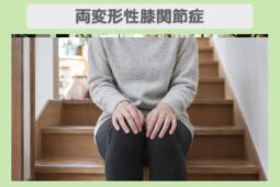 両変形性ひざ関節症 40代女性のイメージ（AI生成・患者本人ではありません）