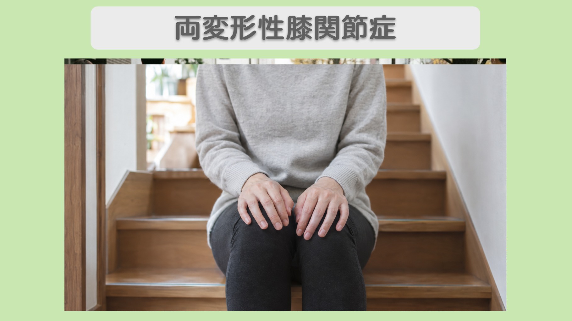 両変形性ひざ関節症 40代女性のイメージ（AI生成・患者本人ではありません）