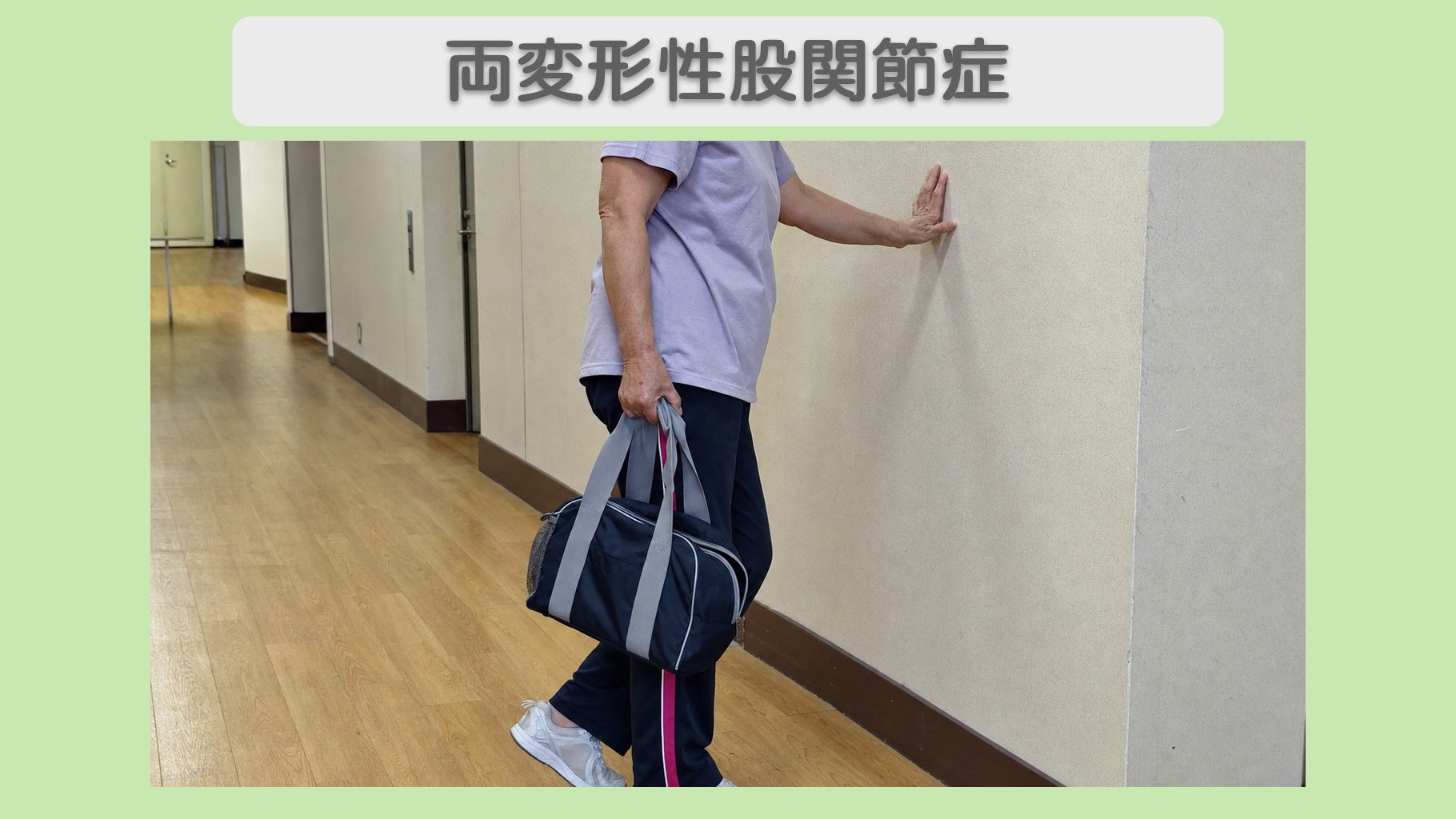 両変形性股関節症 60代女性のイメージ