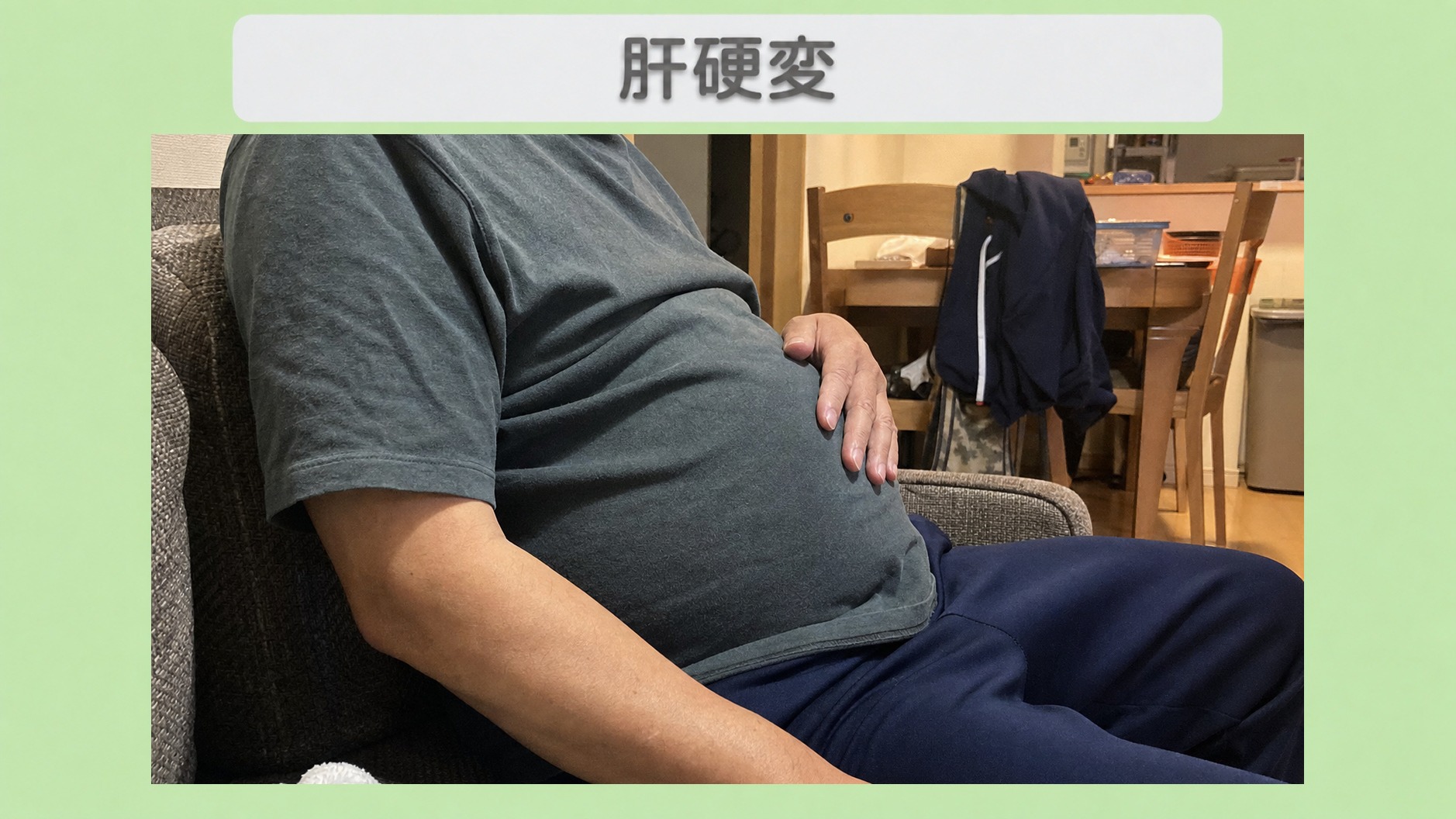 肝硬変 50代男性のイメージ