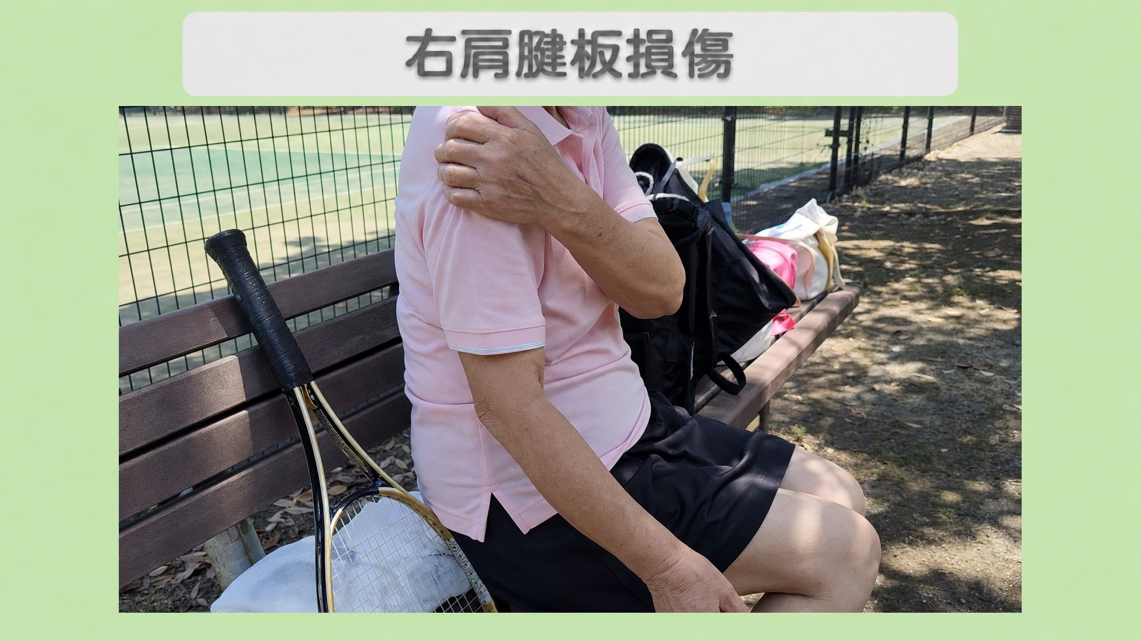 右肩腱板損傷 70代女性のイメージ