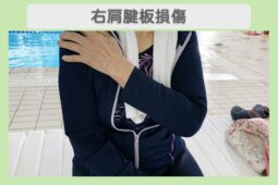 右肩腱板損傷 80代女性のイメージ