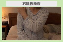右腱板断裂 50代女性のイメージ