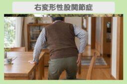 末期右変形性股関節症 60代男性のイメージ（AI生成・患者本人ではありません）