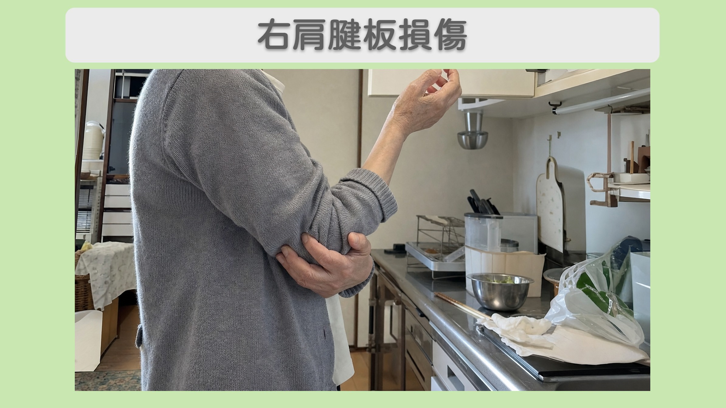 右肩腱板損傷 60代女性のイメージ