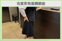 右変形性股関節症 40代女性のイメージ