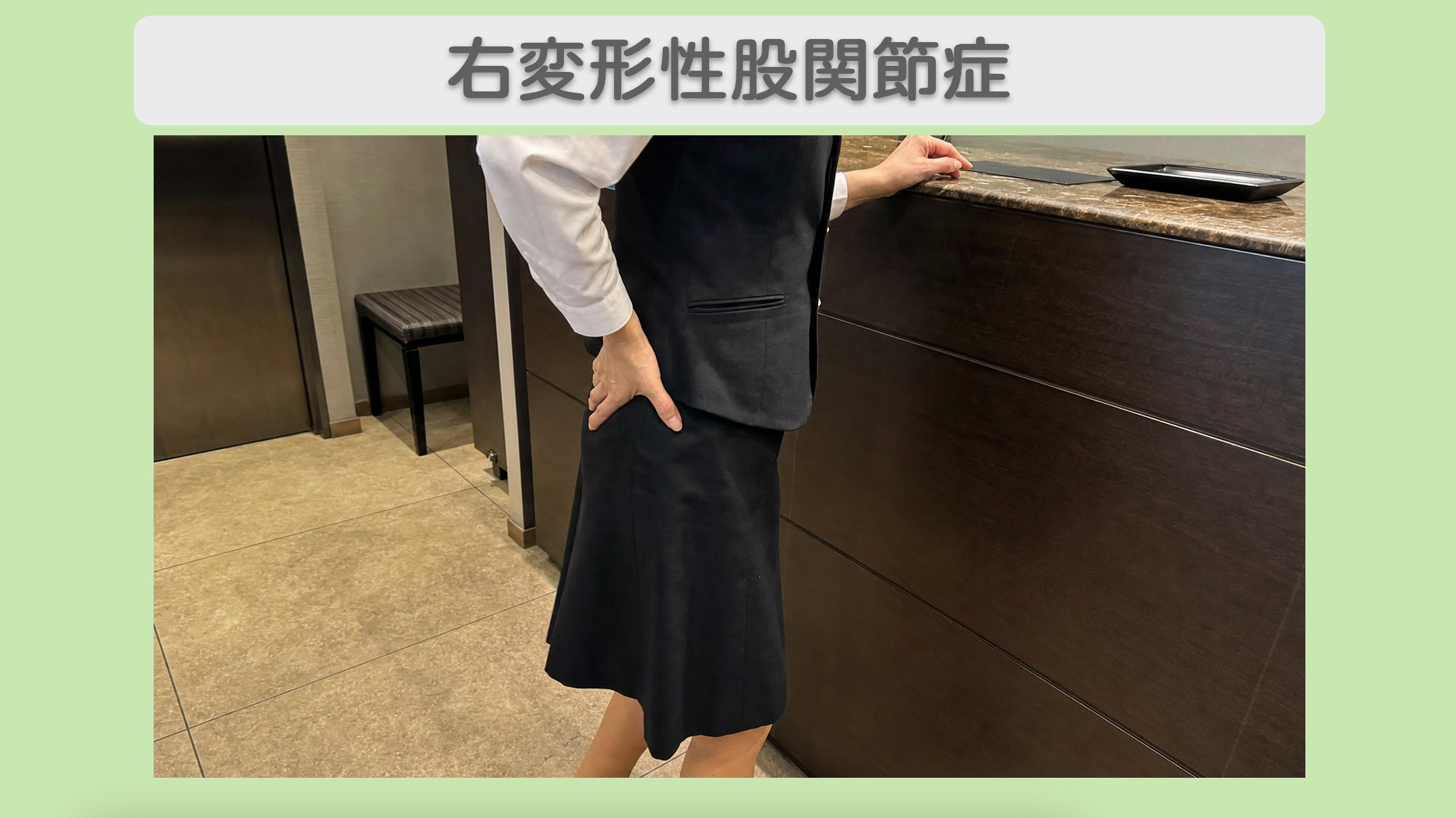 右変形性股関節症 40代女性のイメージ