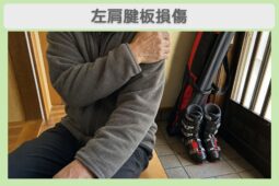 左肩腱板損傷 70代男性のイメージ