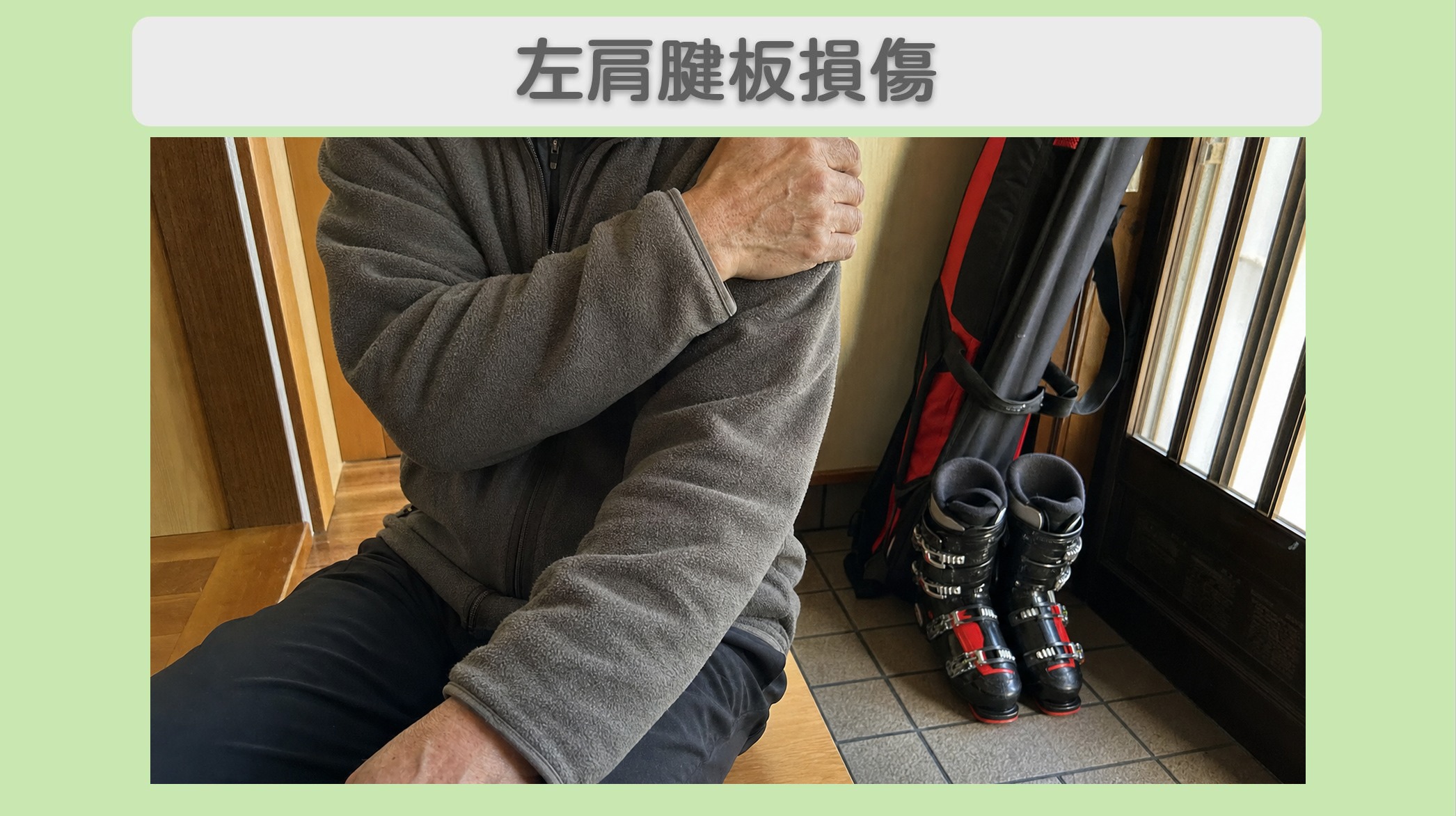 左肩腱板損傷 70代男性のイメージ