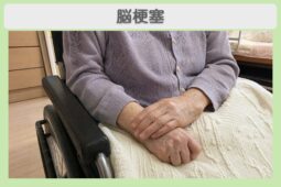 脳梗塞後遺症 80代女性のイメージ