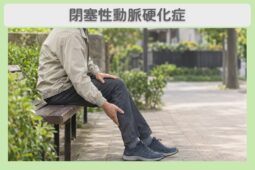 閉塞性動脈硬化症 60代男性のイメージ（AI生成・患者本人ではありません）