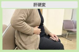 肝硬変 50代女性のイメージ