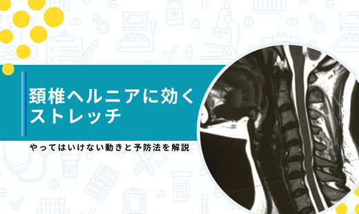頚椎ヘルニア ストレッチ