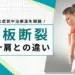 腱板断裂 五十肩 違い