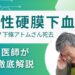 急性硬膜下血腫とは? 医師が徹底解説