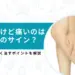 肉離れ 応急処置