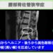 腰部脊柱管狭窄症術後　幹細胞治療