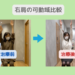 右肩腱板損傷　幹細胞治療