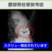 腰部脊柱管狭窄症