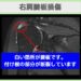 肩腱板損傷