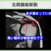肩腱板断裂