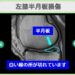 半月板損傷