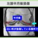 左膝半月板損傷