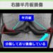 右膝半月板損傷