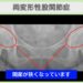 両変形性股関節症のレントゲン画像